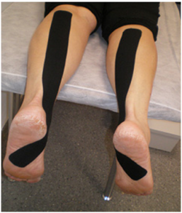 kinesiotape